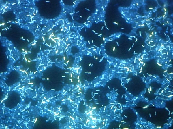 Polymicrobic_biofilm_epifluorescence.jpg